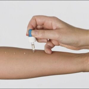 Prick Test