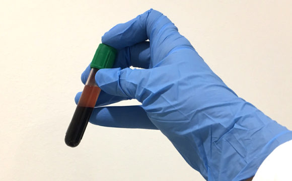 tpi Test de Permeabilidad Intestinal (TPI)