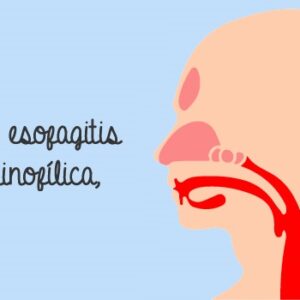 Resultados del TMH en pacientes con esofagitis eosinofílica